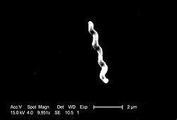  Photographie au microscopie électronique deCampylobacter jejuni