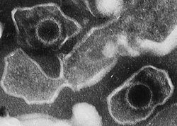  Deux virus d'Epstein-Barr : capside ronde entourée par la membrane plasmique