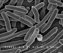  Escherichia coli grossis 25000 fois