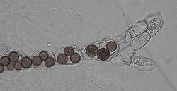  Allomyces sp. (incolore) parasité par Rozella allomycis (brun-gris)
