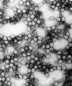  Multiples virions du virus de la fièvre jaune grossissement ×234 000