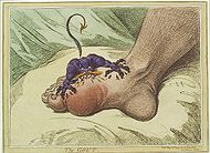 The gout james gillray.jpg