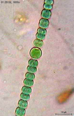 Une cyanobactérie: Anabaena sperica