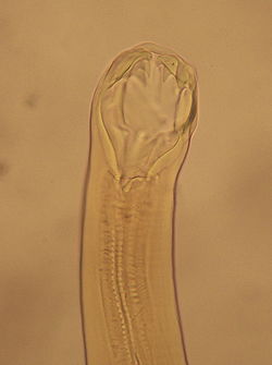 Ancylostoma duodenale