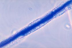  Conidiophore de Aspergillus flavus