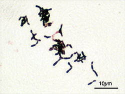  Bifidobacterium adolescentis (×1000) en coloration de Gram, au microscope optique