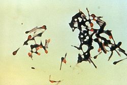  Un groupe de bactéries Clostridium tetani