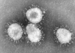  Coronavirus sp.