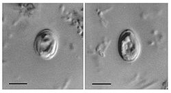  Oocytes de Cryptosporidium muris trouvé dans des fèces humaines