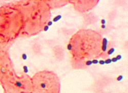  Enterococcus dans des tissus pulmonaires