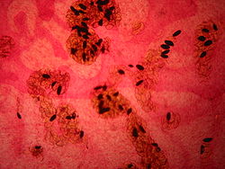 Larves de Fasciola hepatica au microscope,sous-ordre des Echinostomata,famille des Fasciolidae