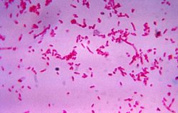  Fusobacterium novum