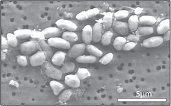 Cellules de bactérie GFAJ-1 sur un milieu contenant de l'arsenic, mais pas de phosphore