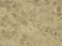  spores de Gonatobotrys