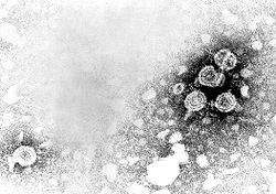  Micrographie montrant l'Hépatite B virions