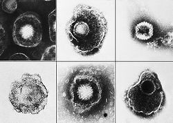  Différents herpèsvirus (dont VZV, HSV-1, HSV-2)