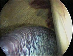 Vue laparoscopique d'une rate de cheval