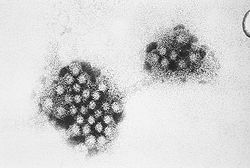  Norovirus sp. (particules virales de 27 à 32 nm)