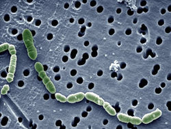  Oenococcus oeni