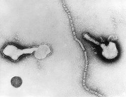  Deux virus Parainfluenza intacts, et une nucléocapside en filament
