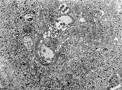 alt= microphotographie en Microscopie électronique en transmission (TEM) de tissu infecté par le Virus de la Fièvre de la vallée du Rift