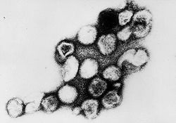 Virus de la rubéole au microscope