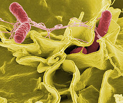  Salmonelles (Salmonella typhimurium), en rouge, sur une culture de cellules humaines