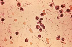 Photographie au microscope de bactéries Shigella dysenteriae