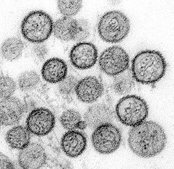  Sin Nombre virus (SNV) , un Hantavirus, au microscope électronique en transmission (MET/TEM)