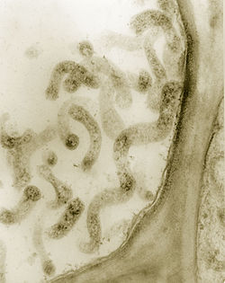  Spiroplasma kunkelii (Stunt du maïs) dans des cellules du ploème.