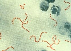  Photographie au microscope debactéries Streptococcus pyogenes