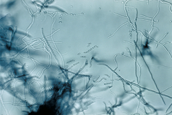  Streptomyces sp. :abondant mycélium aérien, et chaînes de spores, caractéristiques de Streptomyces spp.