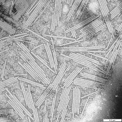  Particules en bâtonnets du virus de la mosaïque du tabac vues au  microscope électronique.