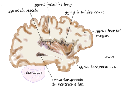 Sagittale-insula-Heschl.png