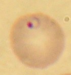  Plasmodium falciparum (trophozoïte dans une hématie)