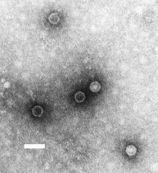  Poliovirus, le virus de la poliomyélite